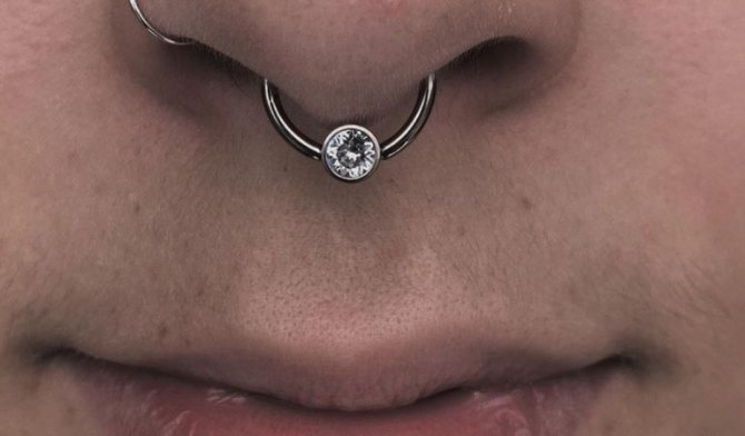le temps de guérison du septum