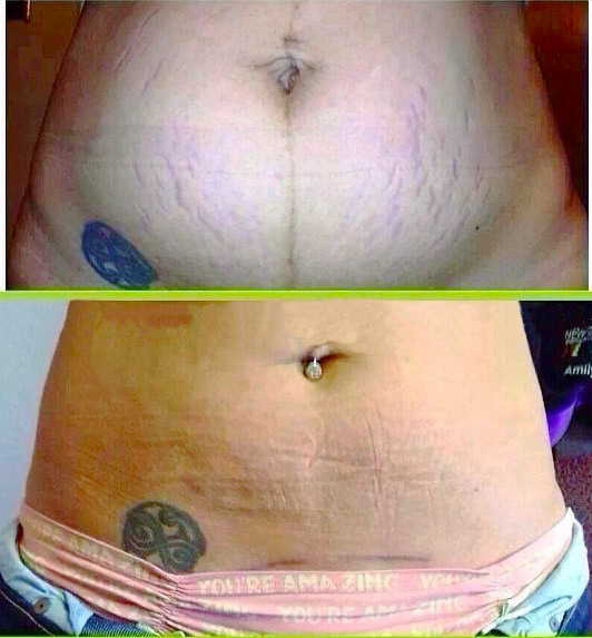 Le tatouage au fil du temps