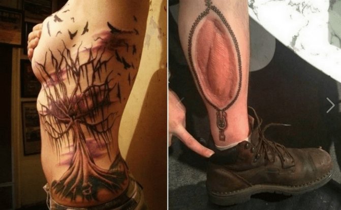 Conseils : Tatouages sur cicatrices