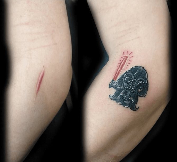 Conseils : Conseils : Tatouage sur les cicatrices