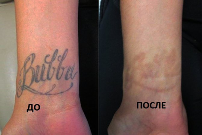 Devrais-je me faire tatouer ? Avantages et inconvénients