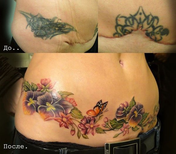 Tatouage pour cacher les points de suture sur votre ventre après une césarienne
