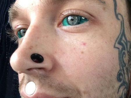 Tatouage vert du globe oculaire