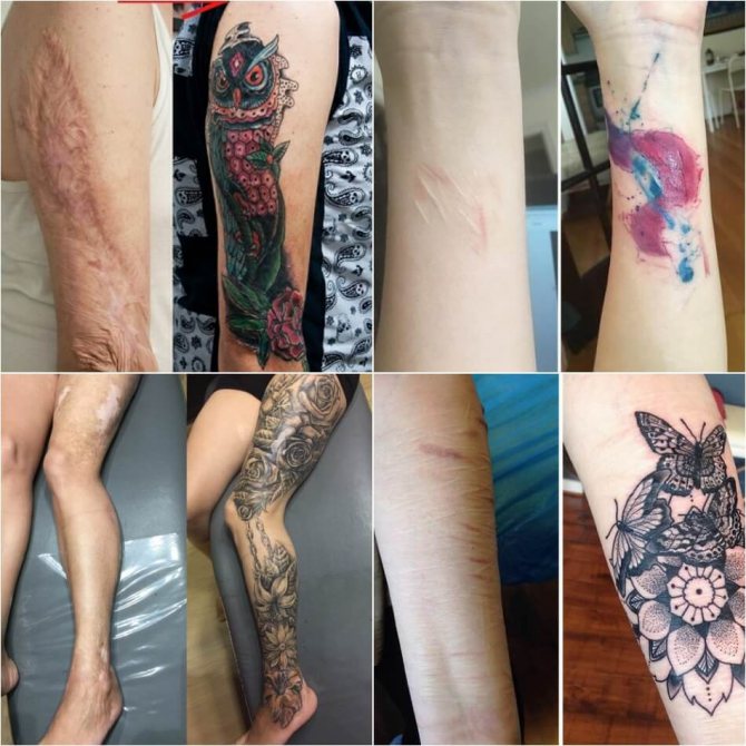 Tatouages de cicatrices - Tatouages de cicatrices - Tatouages de cicatrices