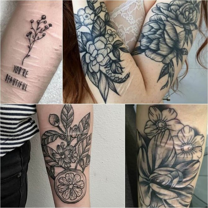 Tatouage sur cicatrices - Tatouage sur cicatrices - Tatouage sur cicatrices - Couverture sur cicatrice
