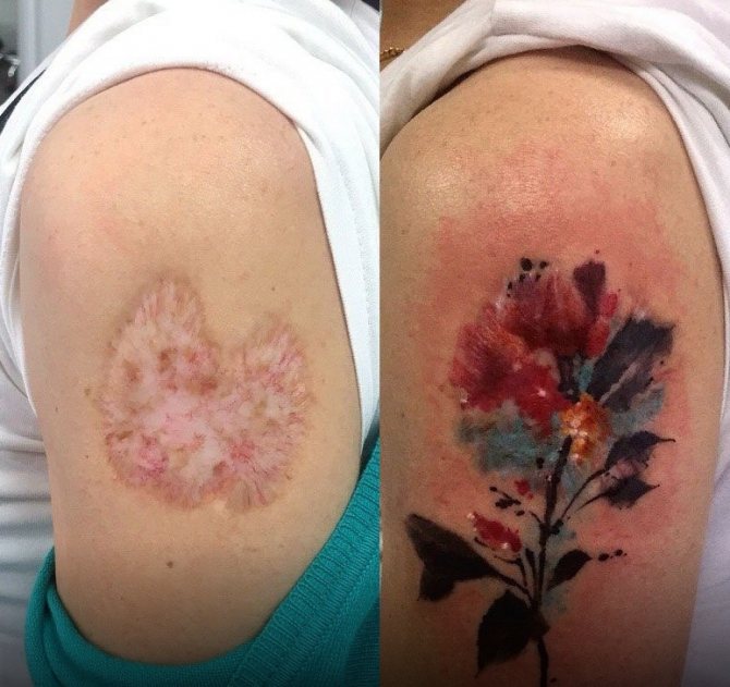 Tatouage sur une cicatrice au bras