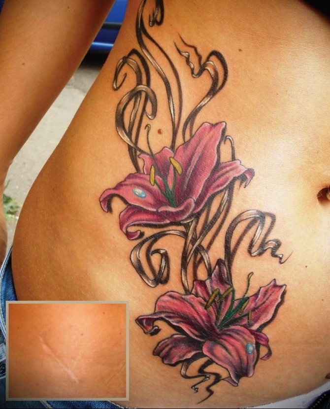 Tatouage sur une cicatrice d'appendicite