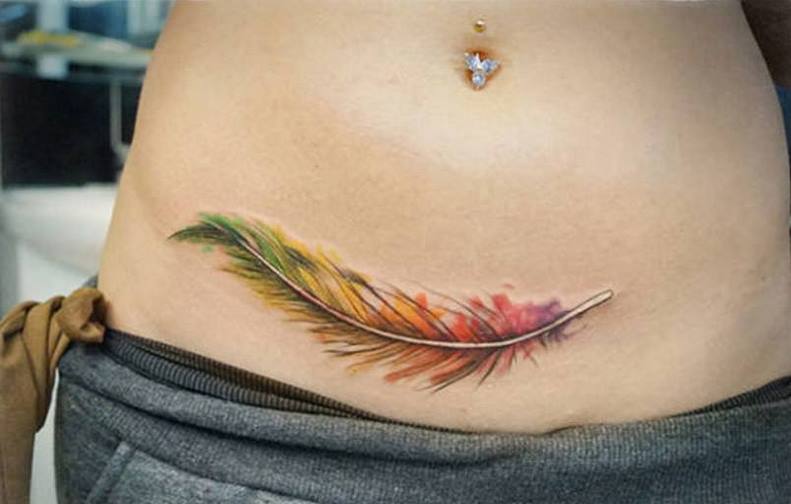 Tatouage sur une cicatrice de césarienne