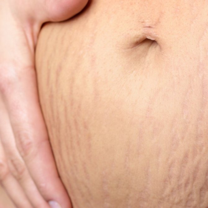 Tatouage sur le ventre du post-partum pour cacher les vergetures