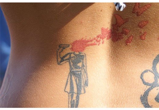 Tatouage d'une tache de naissance sur le dos