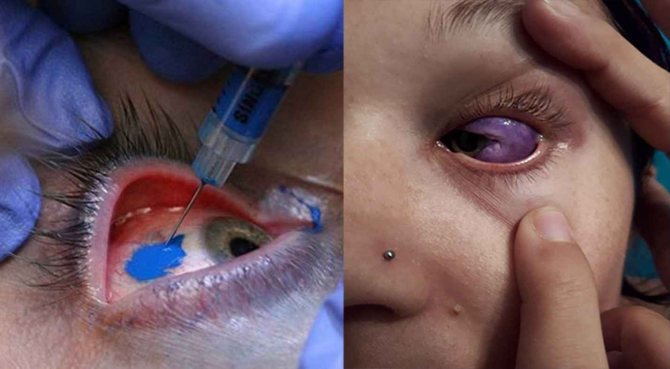 photos de tatouage de globe oculaire