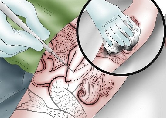 Stick n pokes tatouage permanent