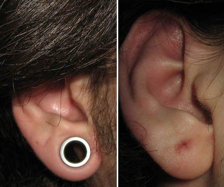 Des tunnels dans les oreilles des filles. Images, vergetures, soins