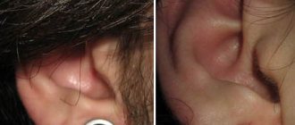 Des tunnels dans les oreilles des filles. Photo, taille des vergetures, soins