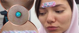 Soins des piercings