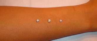 ornements de bras