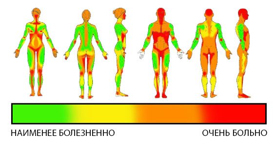 Niveau de douleur des filles et des hommes
