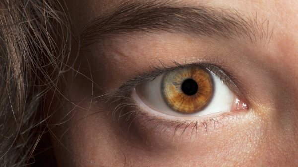 Les yeux jaunes de loup chez les humains. Photo naturelle, causes