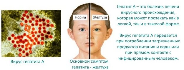 Des yeux de loup jaunes chez un homme. Photo naturelle, causes