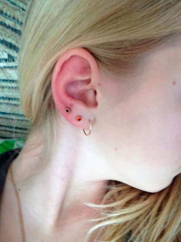 Inflammation du piercing de l'oreille