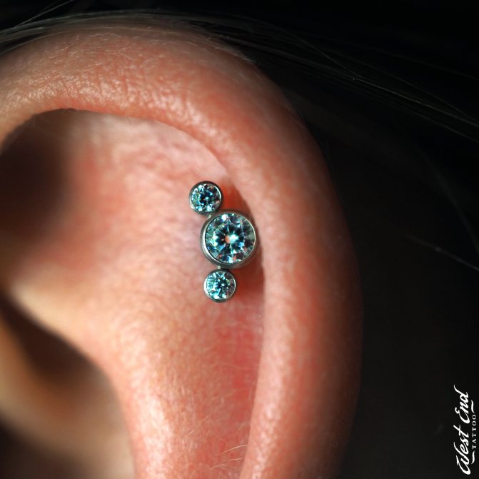 Récupération de la guérison d'un piercing à l'oreille