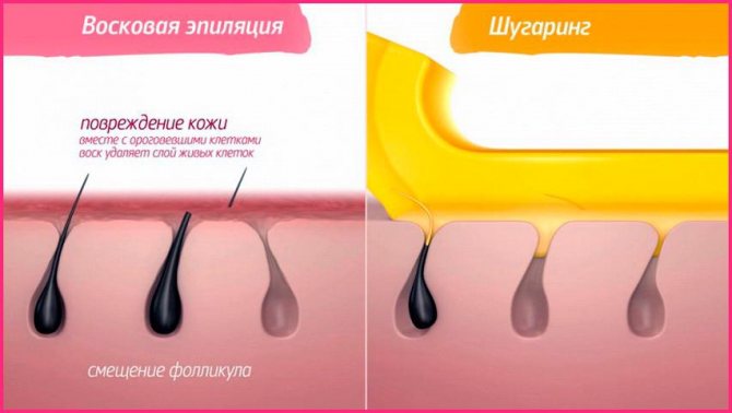 Tout sur les coupes de cheveux intimes, l'épilation et la conception de bikinis pour les hommes et les femmes.