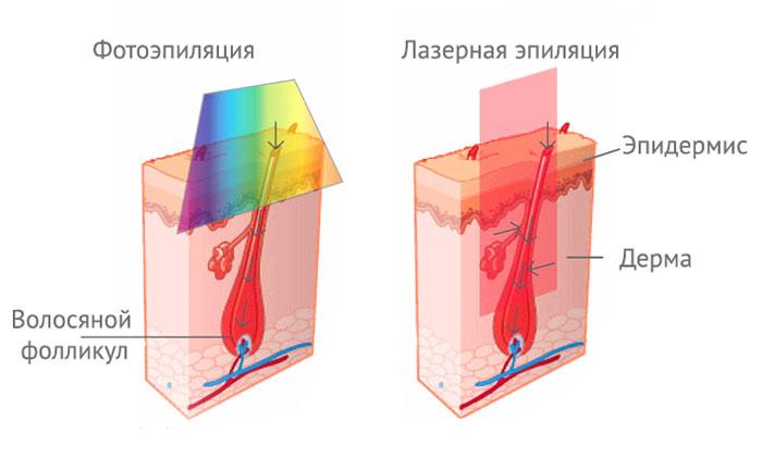 Tout sur les coupes de cheveux en bikini, l'épilation et la conception de bikinis pour les hommes et les femmes.