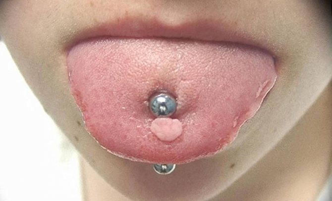 Tout sur le piercing de la langue : perçage, soins, conséquences possibles