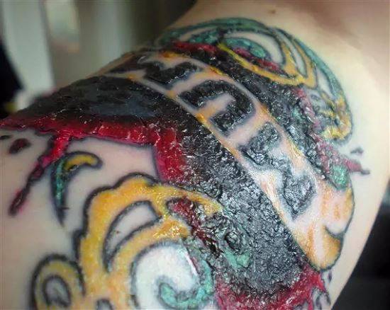 La cicatrisation des tatouages