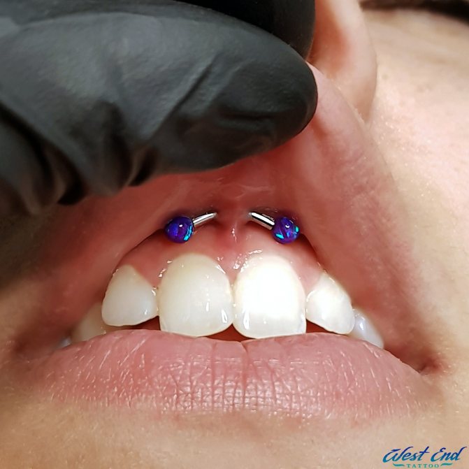 Guérison du piercing à la lèvre