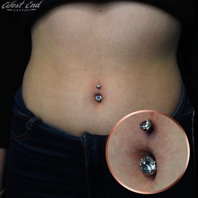 Guérison du piercing du nombril